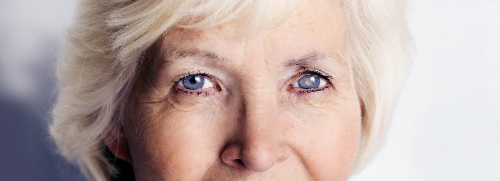 Cataract Surgery in La Junta